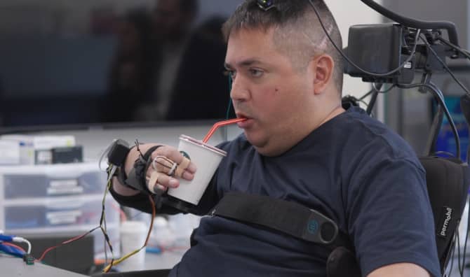 An Innovative Procedure is Restoring Touch to People Who are Paralyzed