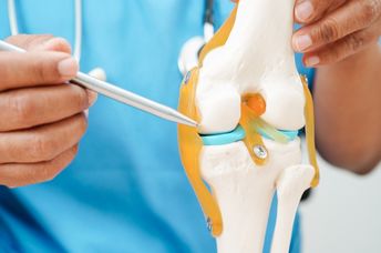 Model of a knee with osteoarthritis.