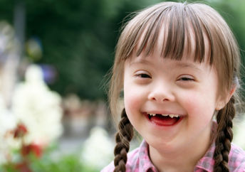 Beautiful child with Downs Syndrome.