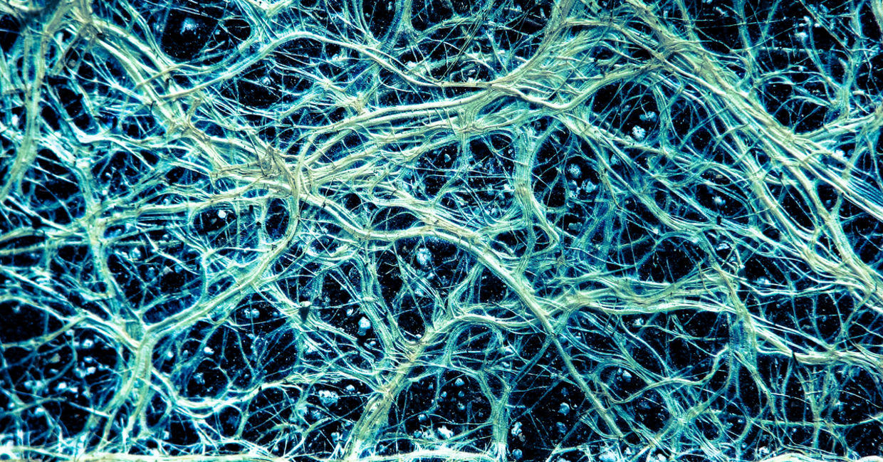Fine vascular root network in plants.