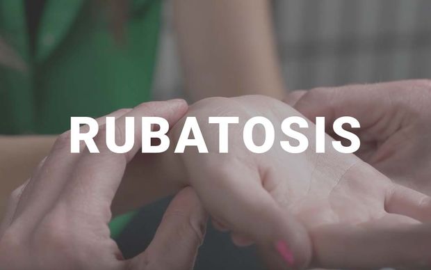 photo A close-up of one person's fingers gently pressing on another person's inner wrist, as if feeling for a pulse, with the word 'RUBATOSIS' displayed in large white capital letters across the center of the image.