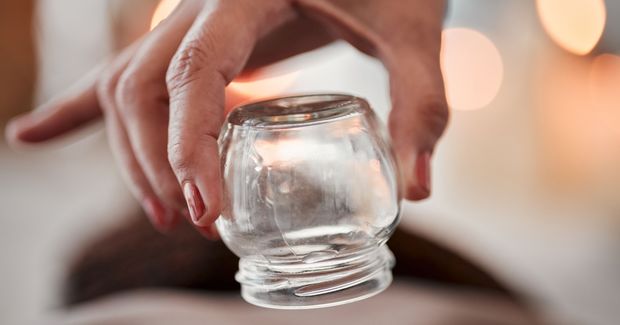 Cupping Cupping is a Traditional Chinese Medicine practice.
